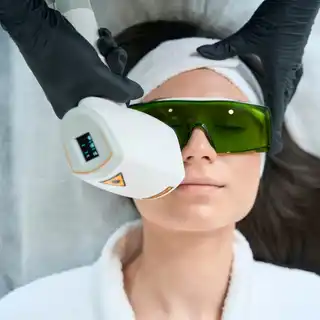 Épilation du visage